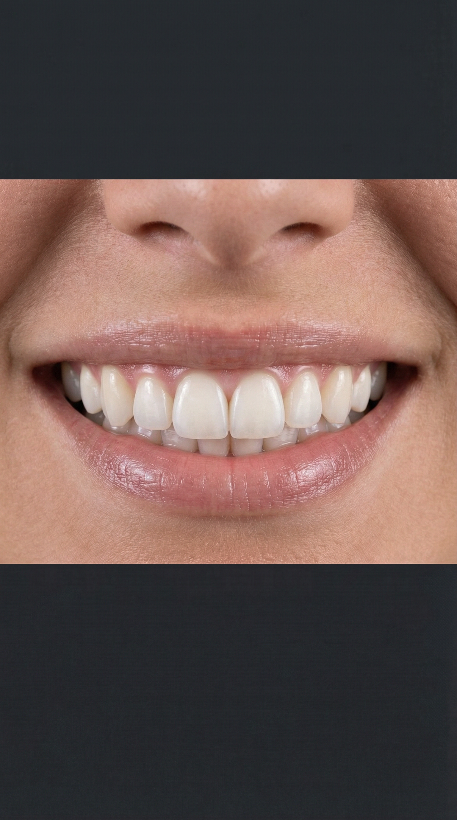 Sonrisa Femenina Perfecta